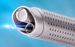 50 ème Intervention laser Clinique du Parc